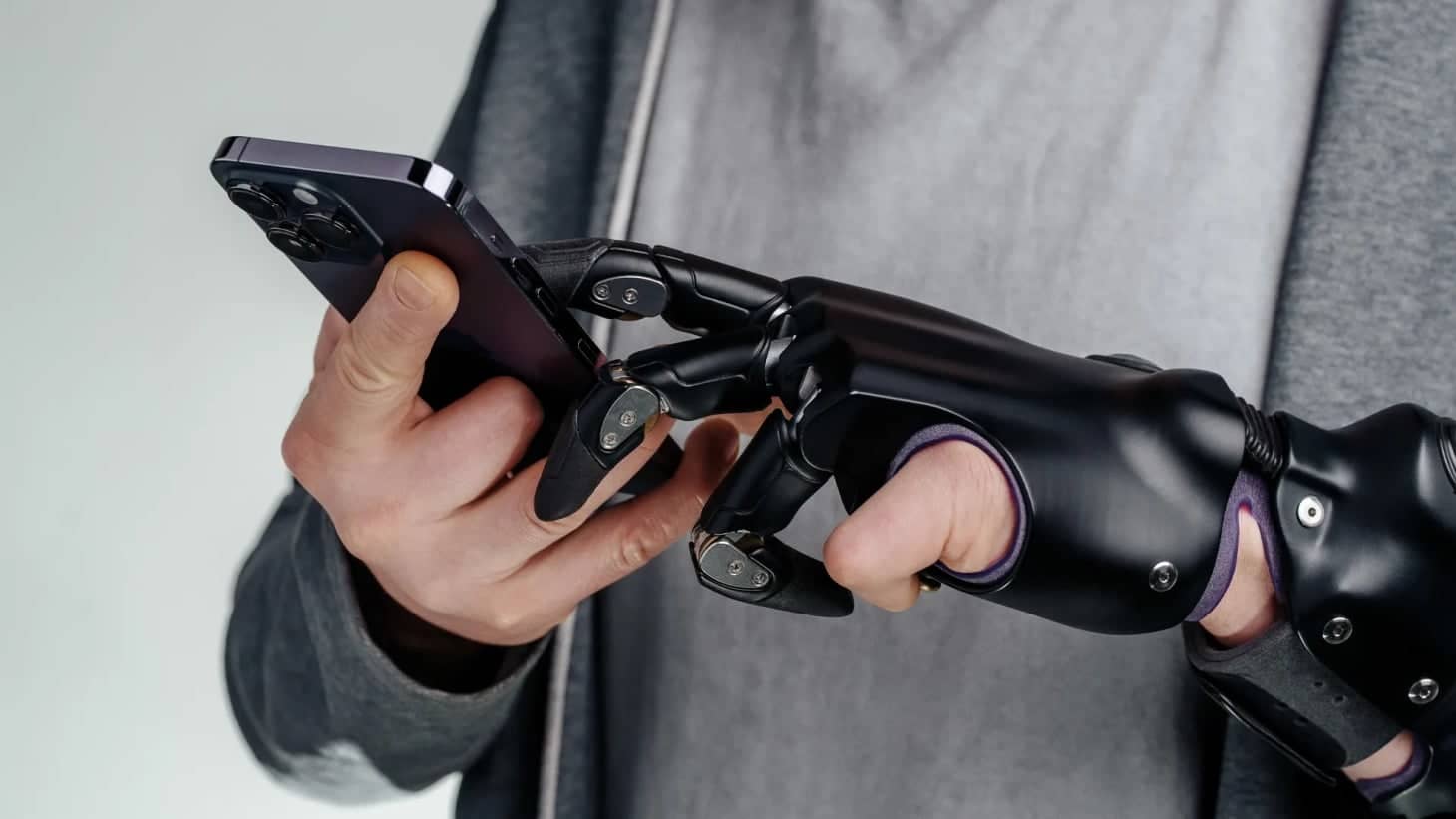 Группа Моторика представила протез локтя: Стандарт и актив