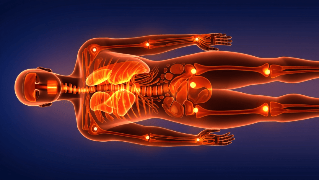 LDL‑C <130 mg/dL no protege: 5 biomarcadores críticos